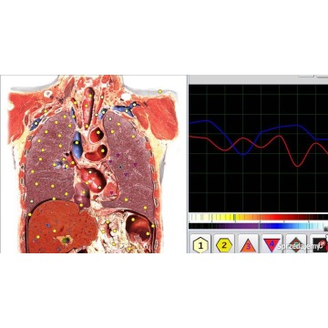 Biorezonans Hunter GR, Vector, Metapathia - Wyposażenie gabinetów,... - Sanok - zdjęcie 3