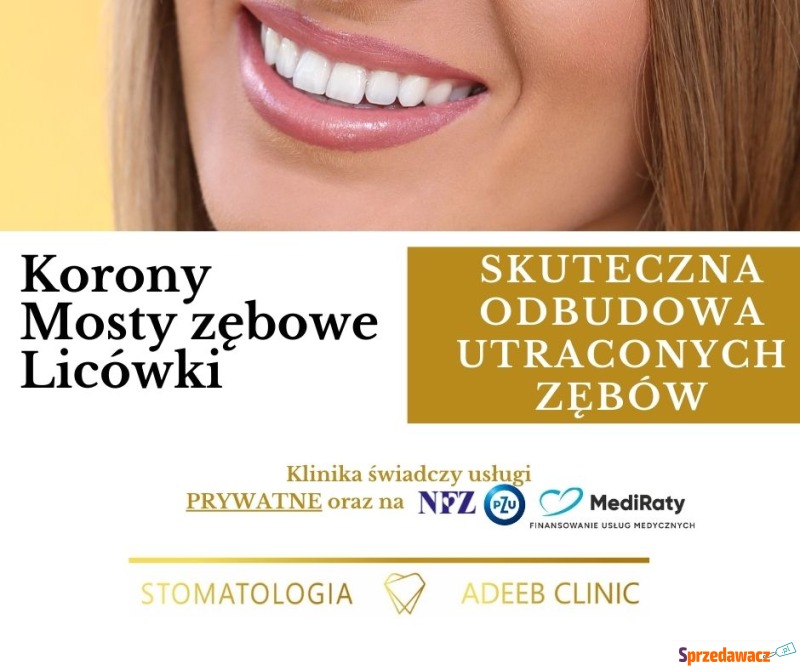 Mosty Korony Licówki Adeeb Clinic Dąbrowa Gór... - Higiena jamy ustnej - Dąbrowa Górnicza